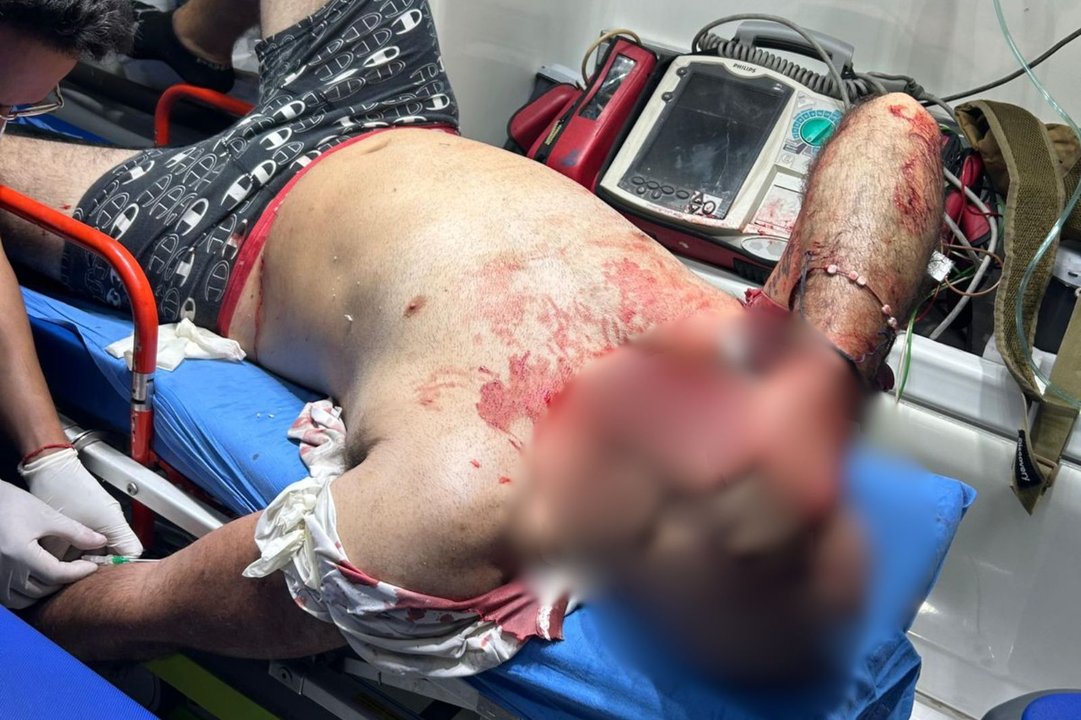 Un policía de civil resistió a tiros un asalto en Ramos Mejía: un herido grave