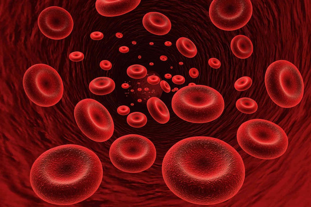 Mielofibrosis en Argentina: 1 de cada 3 pacientes sufre anemia