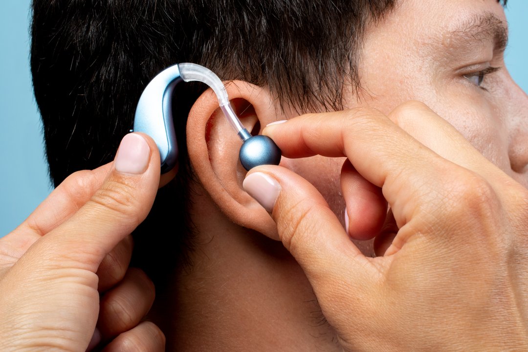 Implantes cocleares: qué cambian estos dispositivos para la audición
