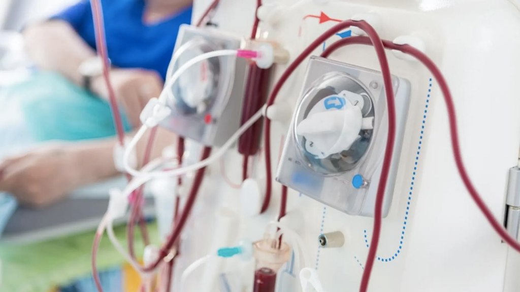En Argentina, hay 30.000 pacientes en diálisis crónica